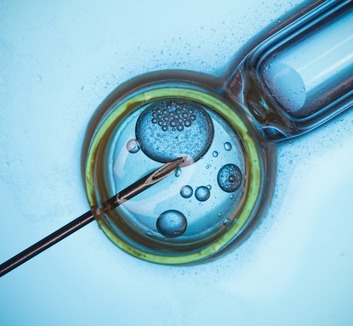 Bővül a lombikkezelések elérhetősége Szerbiában - illusztráció